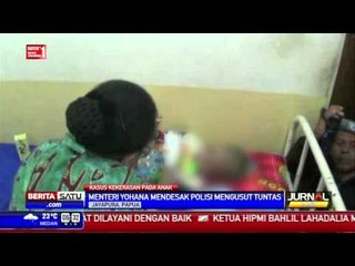 Menteri Yohana Jenguk Bocah Korban Penganiayaan