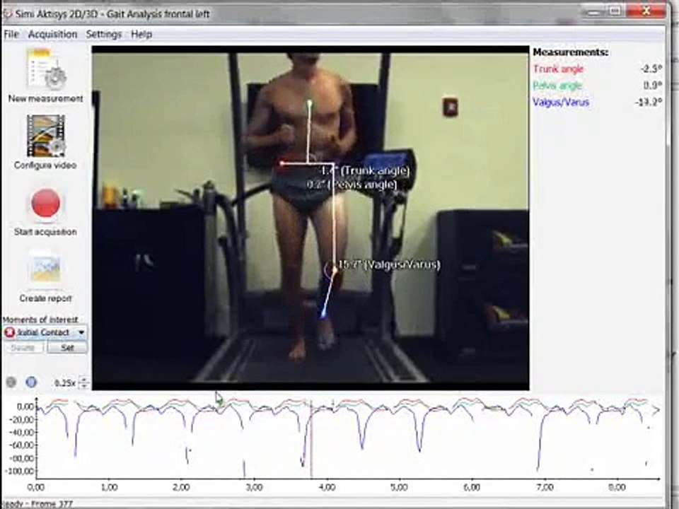 Running Analysis 2D with Simi Aktisys