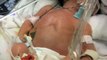 Born Addicts: Drug-Addicted Babies in the United States