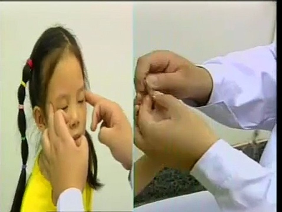 DIY 几种常见病的推拿治疗 (41) 治疗外感发热