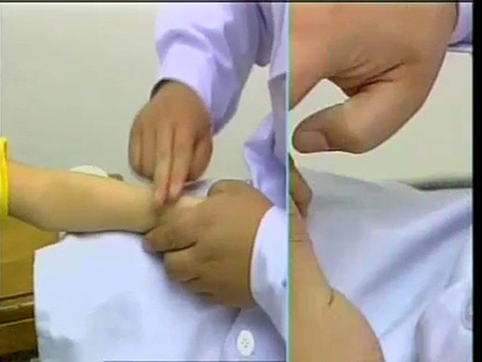 DIY 几种常见病的推拿治疗 (44) 治疗发热