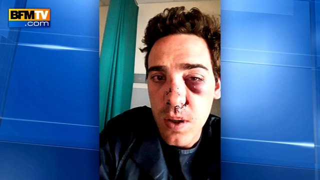 Alexandre, client UberPop agressé: J'ai pris plusieurs coups au visage