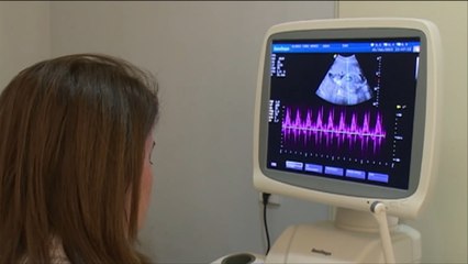 أعلى معدلات الإجهاض الاختياري بأذربيجان