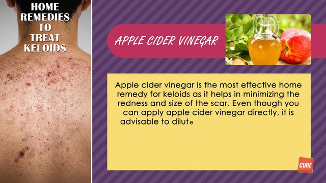 keloids Home Remedies Health Tone Tips Cube Films