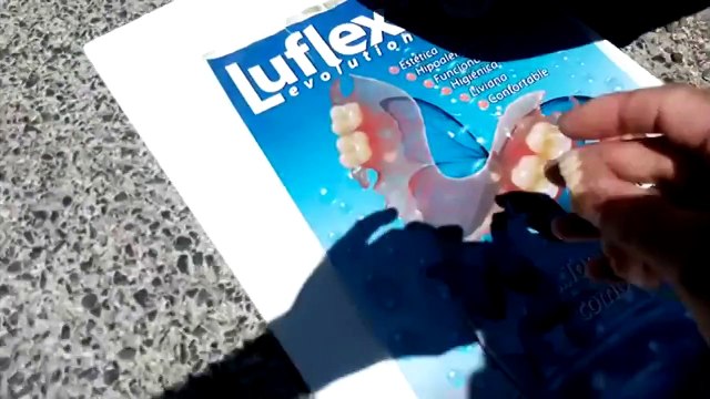 Protese flexivel _Sacavem_ Proteses dentarias esteticas Lisboa_sacavem_new