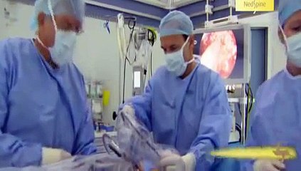 minimaal invasieve Spondylodese operatie, uitgevoerd door Dr. George Homminga