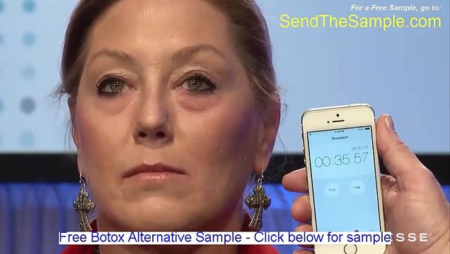 Before and after Botox - See important Video - Arlington