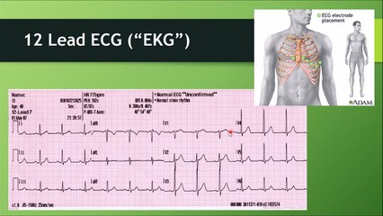 Differentiating Acute Coronary Syndrome (ACS) - (Nursing)