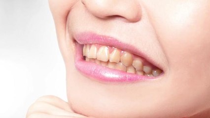 5 Things you never knew could damage your smile