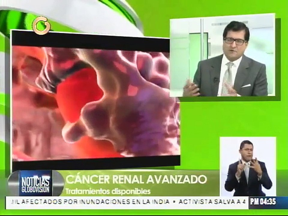 Cáncer renal avanzado puede reaparecer tras cirugía