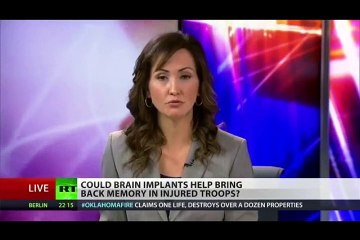 DOD Putting Mind Reading Brain Implants in People