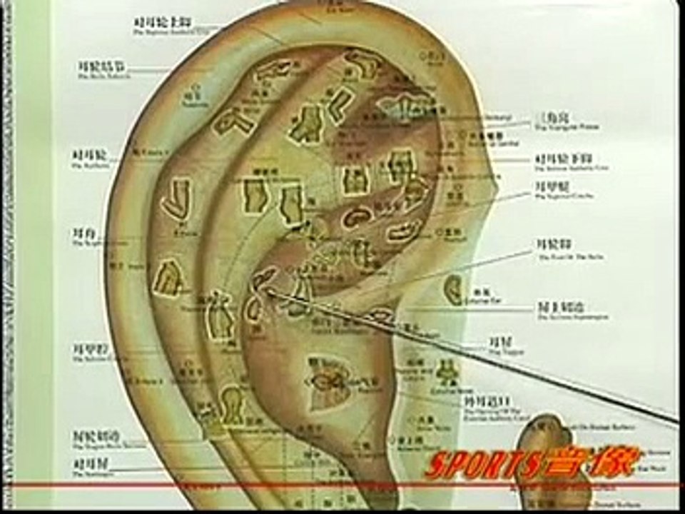 DIY 健康保健耳穴按摩 (12) 治疗呃逆