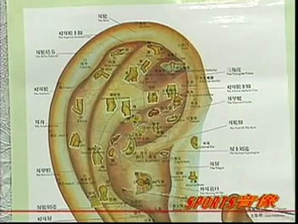 DIY 健康保健耳穴按摩 (26) 治疗落枕