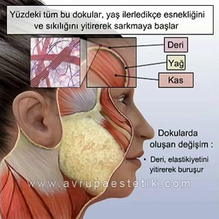 Endoskopik yüz germe ameliyatı videosu | Dr. Nazmi BAYÇIN