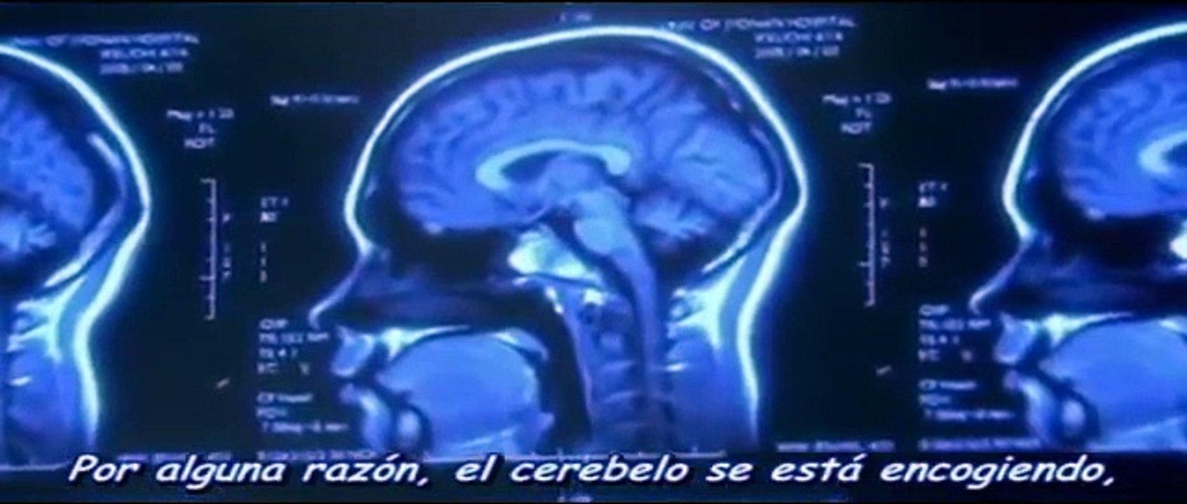 LA HISTORIA DE AMOR MAS TRISTE DEL MUNDO,musica - "song for lover " pelicula - un litro de lagrimas