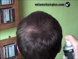 Loose 10 years in 5 minutes and STOP suffering from hairloss, thin or thinning hair.