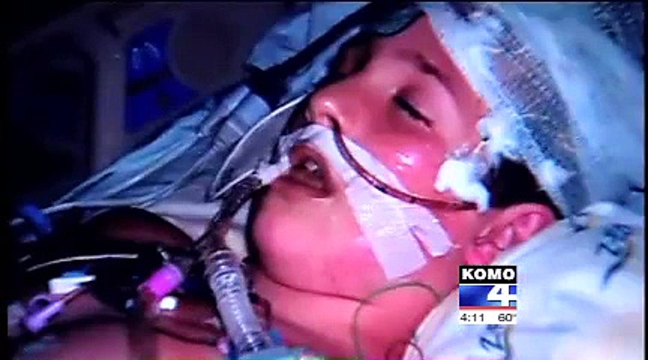 'He stopped breathing, and his pulse stopped'