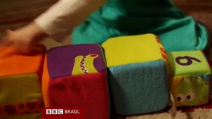 Protese de Nariz  da Impressora de 3D