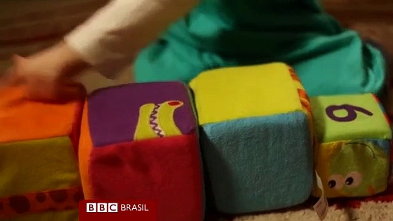 Protese de Nariz  da Impressora de 3D