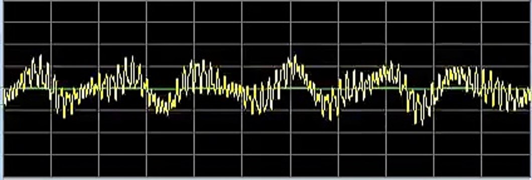 Insomnia - Rife Frequencies