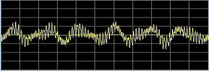 Insomnia - Rife Frequencies