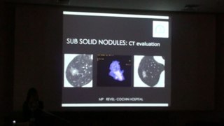 Sub Solid Nodules CT evalution - Marie Pierre Revel
