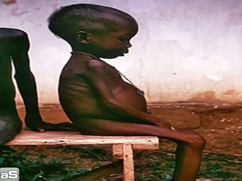 Africa For Real - an awarness video about hunger and malaria in Africa