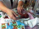 Our 1lb 2oz 25 week Micro Preemie Miracle, ALEXIS LILY - NICU Journey