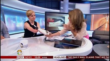 First woman with real bionic hand demonstrates it use