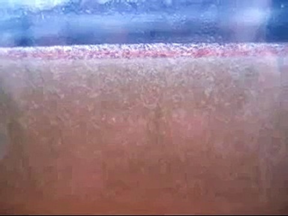 Vinegar Eels