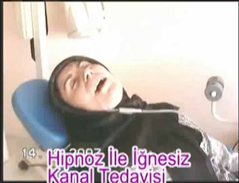 Hipnoz İle Kanal Tedavisi