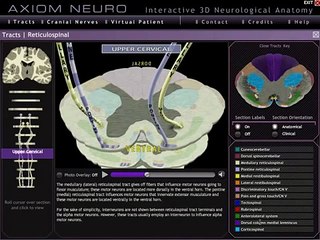 Axiom Neuro 3D Neuroanatomy - Tracts and Pathways Module