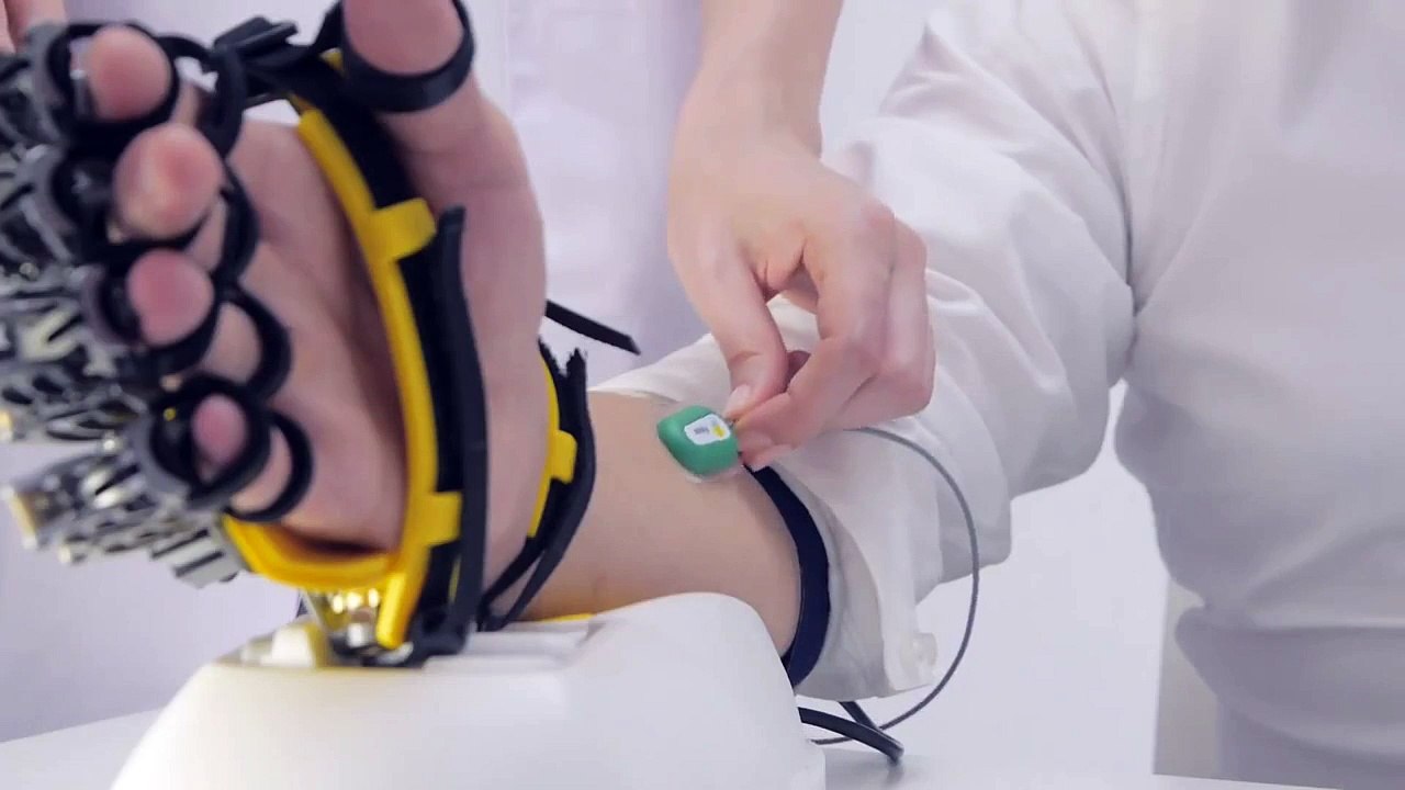 Hand of Hope - robotic arm after stroke rehabilitation exercise