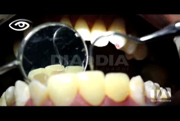 SALUD DENTAL EN NIÑOS