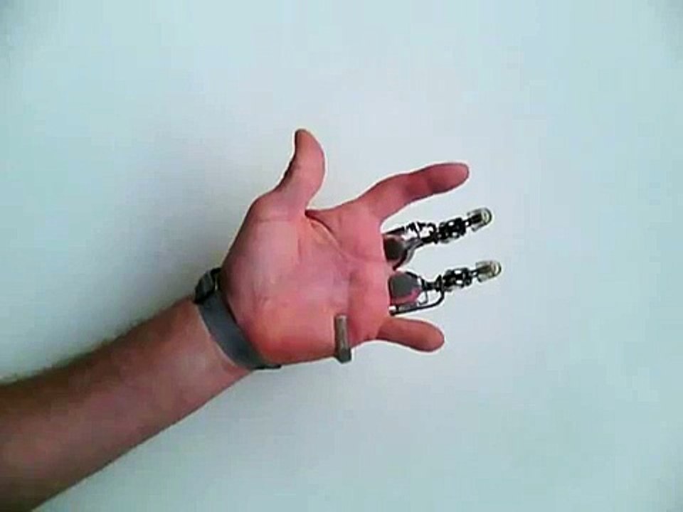 X-Fingers by Didrick Medical Inc.