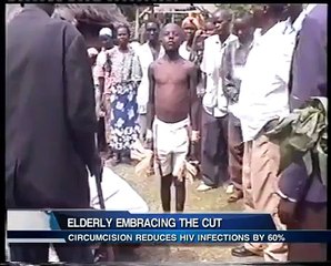 MALE CIRCUMCISION