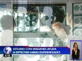 Equipo duplicará capacidad del Calderón Guardia para detectar varias enfermedades