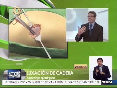 Especialista: Quien sufre de displasia de caderas se puede recuperar