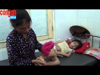 Mong manh cuộc sống bé gái không có tiền phẫu thuật