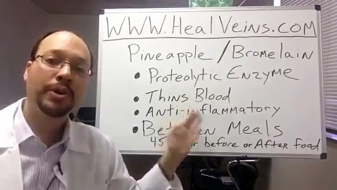 varicose vein in leg.