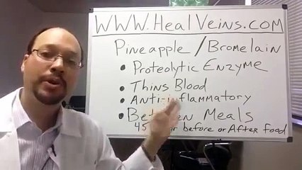 varicose vein in leg.