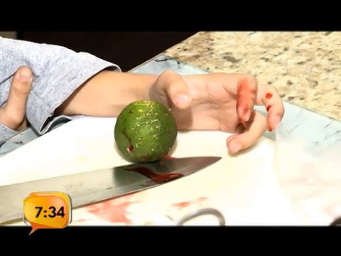 Aprenda a tratar heridas menores en los niños