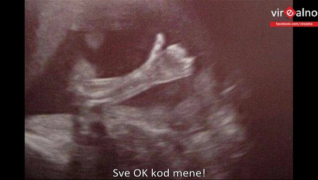 Babies giving thumbs up in womb