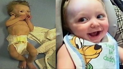 Parents Starve Baby Nearly To Death & Get 60 Yrs In Jail