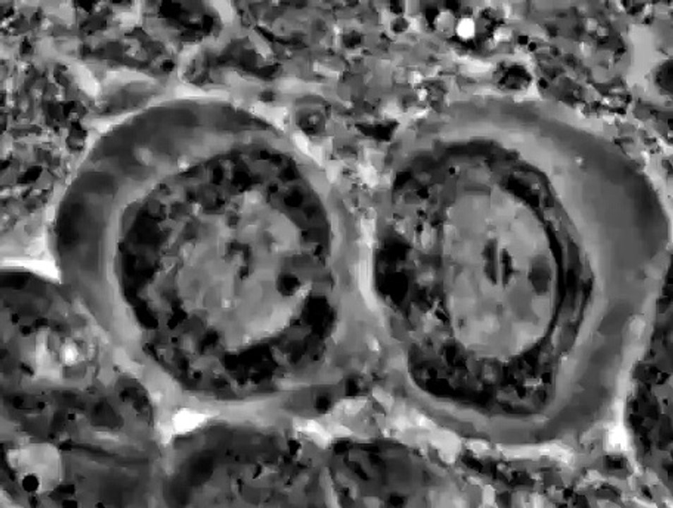 Meiosis I Drosophila spermatocyte