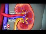 Tv9 Gujarat - Mumbai hospital conduct India's first domino kidney transplant surgery
