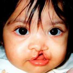 Together we can make our children SMILE.