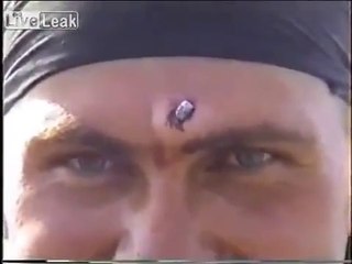 Скачать видео: AK-47 bullet removed from Russian soldier's head