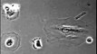 Human hair dermal papilla cell motility