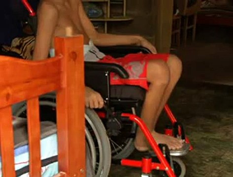 Jornal Local: alta menino baleado